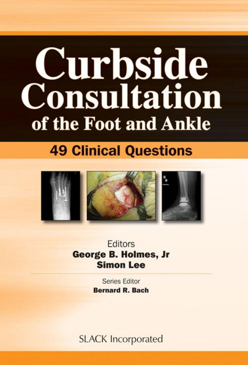 Cover of the book Curbside Consultation of the Foot and Ankle by , SLACK Incorporated