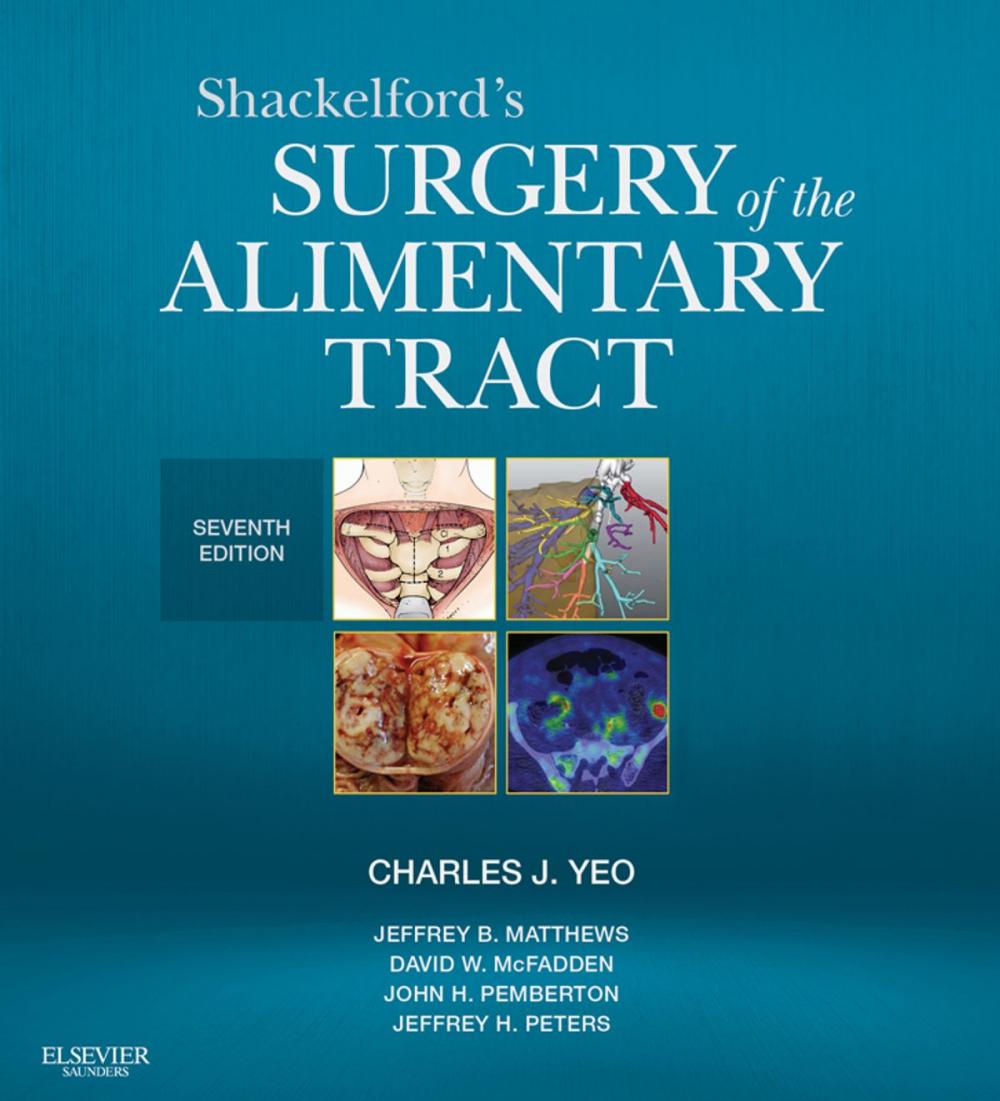Big bigCover of Shackelford's Surgery of the Alimentary Tract E-Book