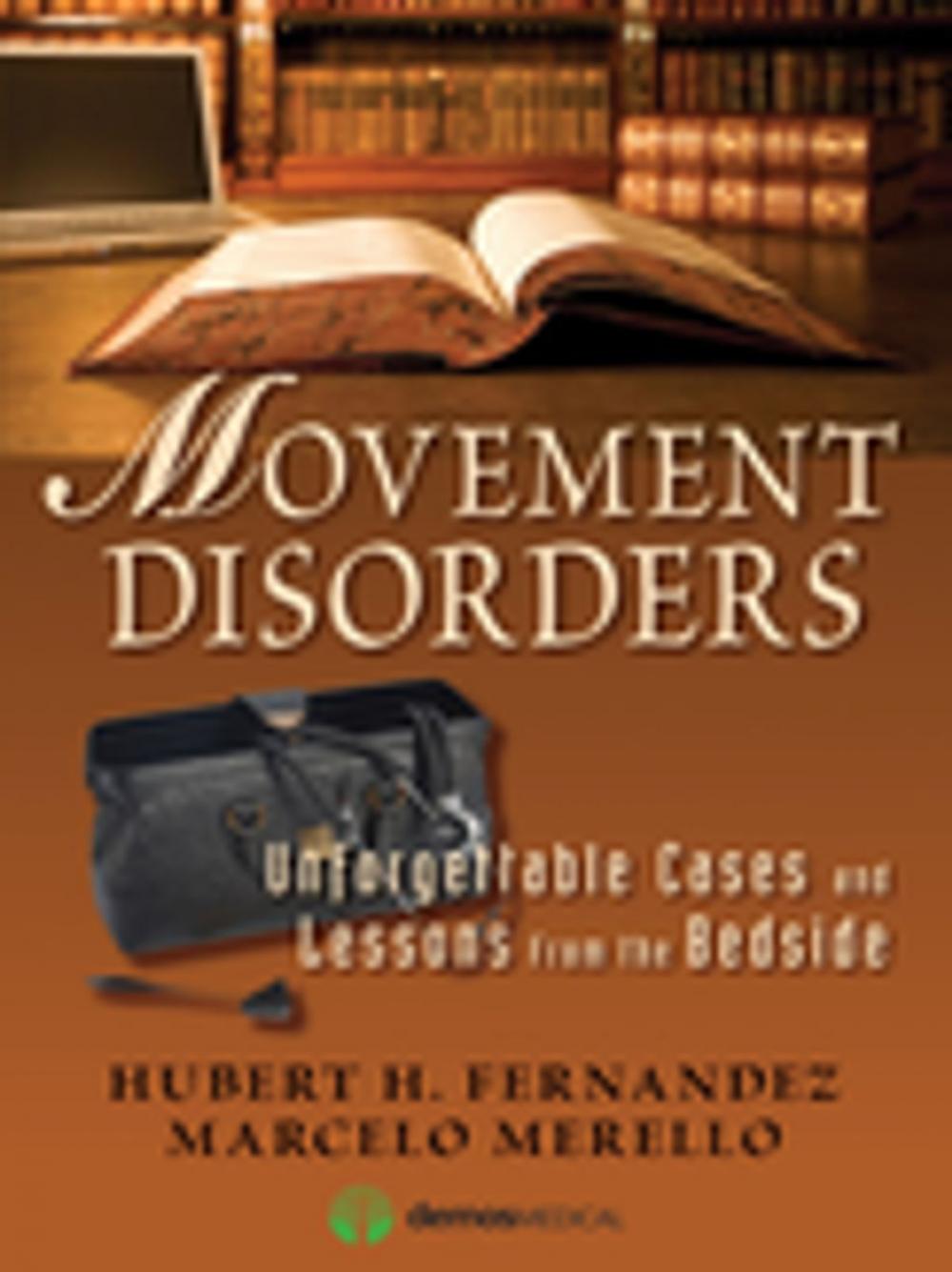 Big bigCover of Movement Disorders
