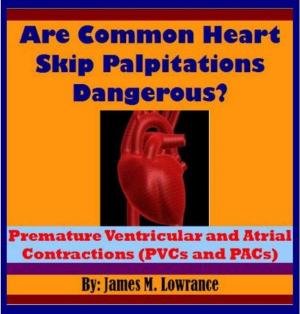 Cover of the book Are Common Heart Skip Palpitations Dangerous? by James Lowrance