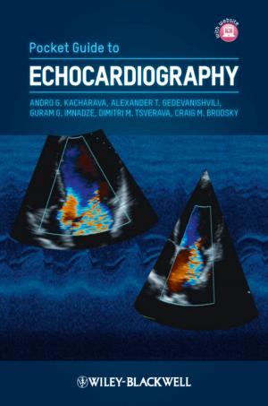 Cover of the book Pocket Guide to Echocardiography by Consumer Dummies