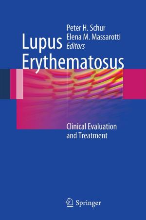 Cover of the book Lupus Erythematosus by Shahid Alvi