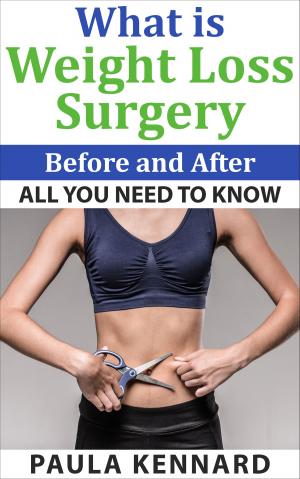 Book cover of What Is Weight Loss Surgery: All You Need To Know Before And After