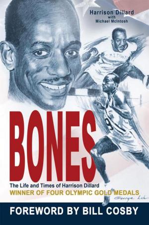Cover of the book Bones by Lilian Nirupa
