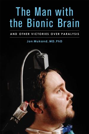 Cover of the book The Man with the Bionic Brain by R. Kent Rasmussen