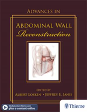 Cover of the book Advances in Abdominal Wall Reconstruction by Mario Sanna, Fernando Mancini