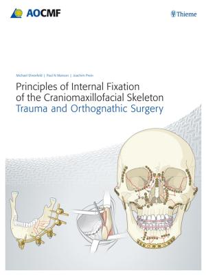 Cover of the book Principles of Internal Fixation of the Craniomaxillofacial Skeleton by George Laskaris