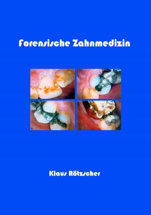 Cover of the book Forensische Zahnmedizin by Alexander Kronenheim