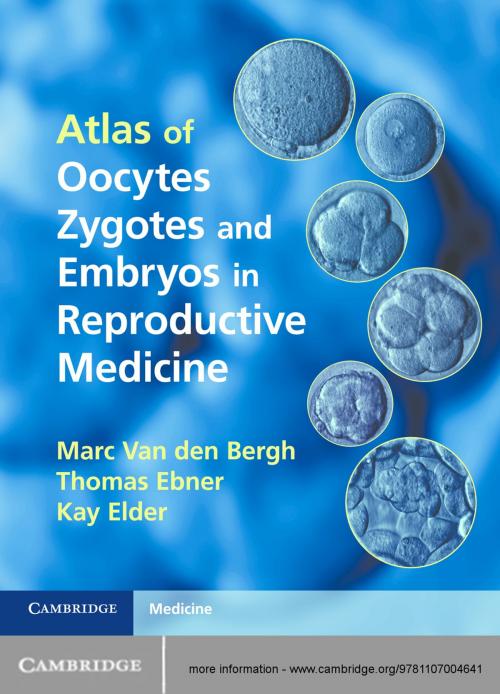 Cover of the book Atlas of Oocytes, Zygotes and Embryos in Reproductive Medicine by Marc Van den Bergh, Professor Thomas Ebner, Kay Elder, Cambridge University Press