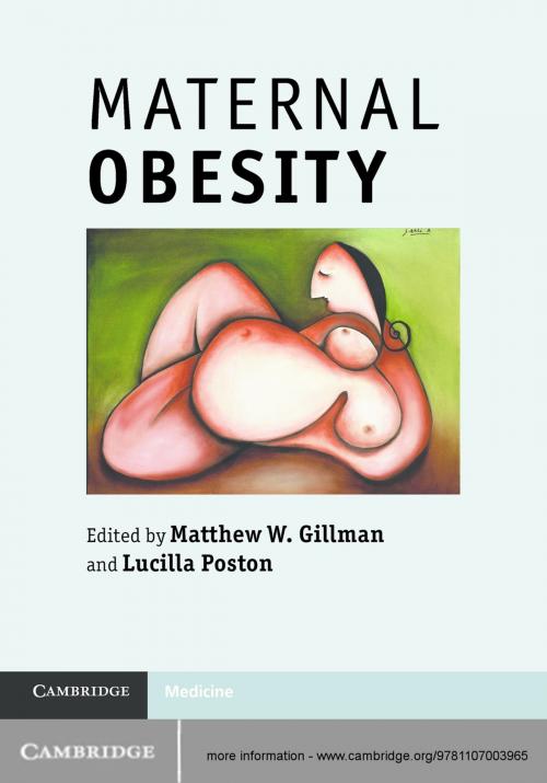 Cover of the book Maternal Obesity by , Cambridge University Press