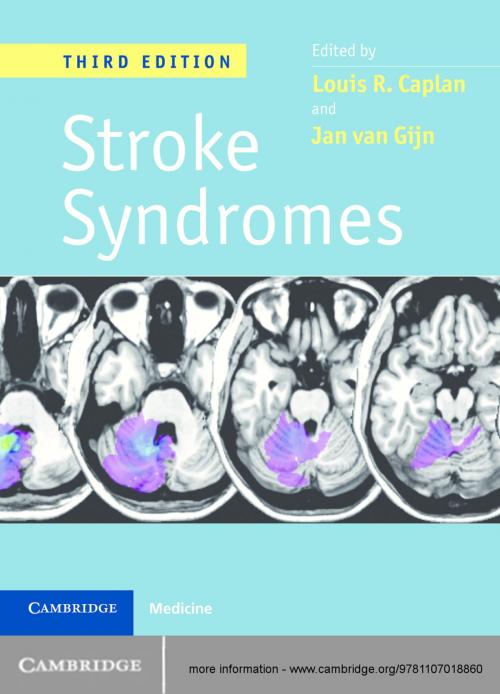 Cover of the book Stroke Syndromes, 3ed by , Cambridge University Press