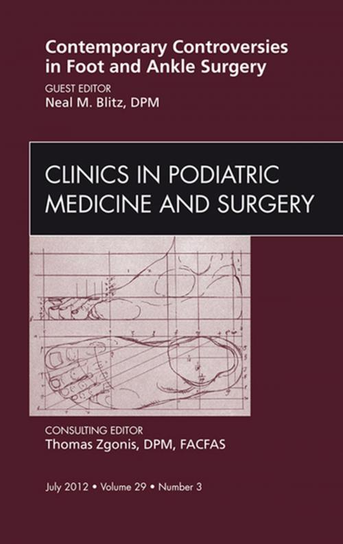 Cover of the book Contemporary Controversies in Foot and Ankle Surgery, An Issue of Clinics in Podiatric Medicine and Surgery - E-Book by Neil Blitz, DPM, FACFAS, Elsevier Health Sciences