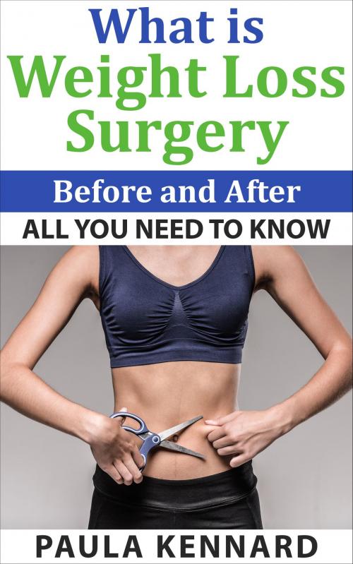 Cover of the book What Is Weight Loss Surgery: All You Need To Know Before And After by Paula Kennard, AP Publishing
