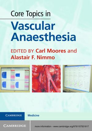 Cover of the book Core Topics in Vascular Anaesthesia by Thomas Fehlner, Jean-Francois Halet, Jean-Yves Saillard