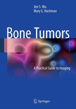 Cover of the book Bone Tumors by Harold Gardner