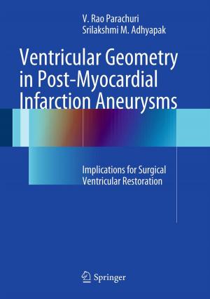 Cover of the book Ventricular Geometry in Post-Myocardial Infarction Aneurysms by Gerard O'Regan