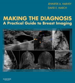Cover of the book Making the Diagnosis: A Practical Guide to Breast Imaging E-Book by Megan-Jane Johnstone, PhD, BA, RN