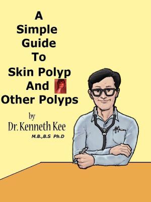 bigCover of the book A Simple Guide to Skin Polyp and Other Polyps by 