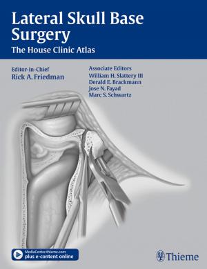Cover of the book Lateral Skull Base Surgery by Thomas Zeller, Thomas Cissarek, William A. Gray