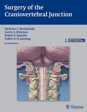 Cover of the book Surgery of the Craniovertebral Junction by Ursus-Nikolaus Riede, Martin Werner