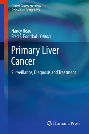 Cover of the book Primary Liver Cancer by Joseph A. Prahlow
