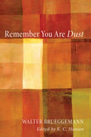 Cover of the book Remember You Are Dust by Gary W. Burnett