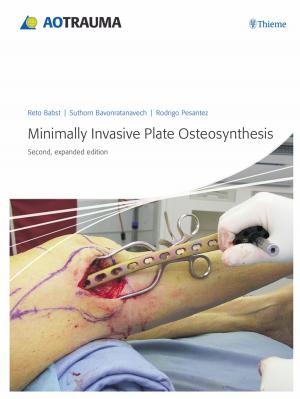 Cover of the book Minimally Invasive Plate Osteosynthesis (MIPO) by Tibor Tot, Laszlo Tabar, Peter B. Dean