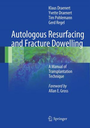 Cover of the book Autologous Resurfacing and Fracture Dowelling by Nina Konopinski-Klein, Dagmar Seitz, Joanna Konopinski
