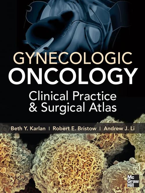 Cover of the book Gynecologic Oncology: Clinical Practice and Surgical Atlas by Beth Y Karlan, Robert E. Bristow, Andrew John Li, McGraw-Hill Education