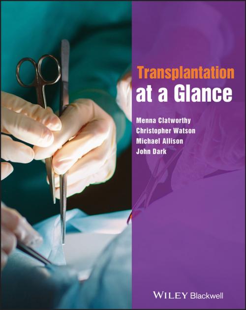 Cover of the book Transplantation at a Glance by Menna Clatworthy, Christopher Watson, Michael Allison, John Dark, Wiley