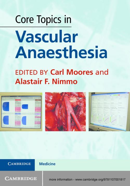 Cover of the book Core Topics in Vascular Anaesthesia by , Cambridge University Press