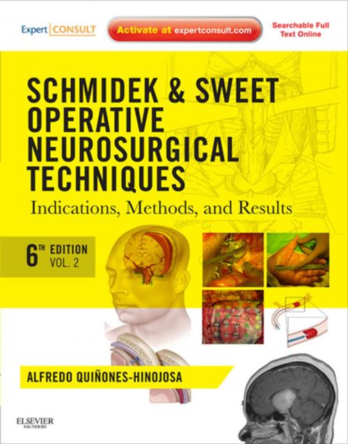 Cover of the book Schmidek and Sweet: Operative Neurosurgical Techniques E-Book by Alfredo Quinones-Hinojosa, MD, FAANS, FACS, Elsevier Health Sciences
