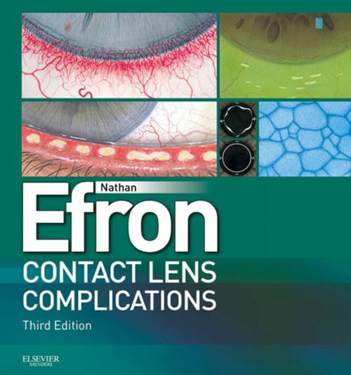 Cover of the book Contact Lens Complications E-Book by Nathan Efron, BScOptom PhD (Melbourne), DSc (Manchester), FAAO (Dip CCLRT), FIACLE, FCCLSA, FBCLA, FACO, Elsevier Health Sciences