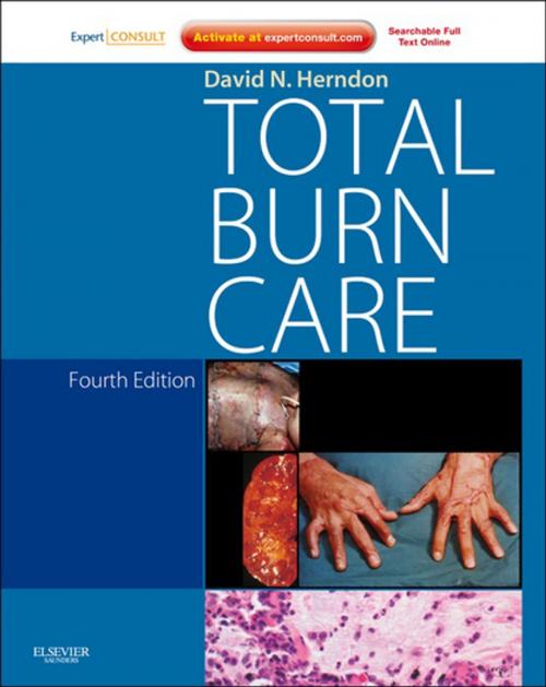 Cover of the book Total Burn Care by David N. Herndon, MD, FACS, Elsevier Health Sciences