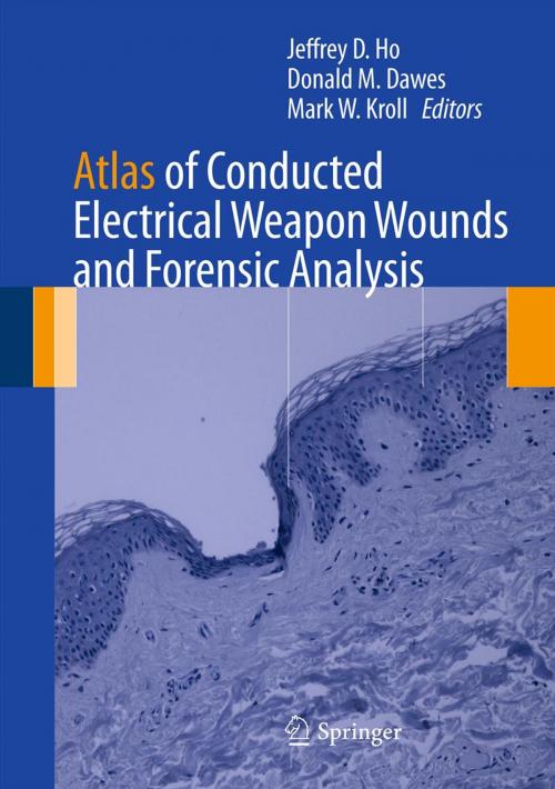 Cover of the book Atlas of Conducted Electrical Weapon Wounds and Forensic Analysis by , Springer New York
