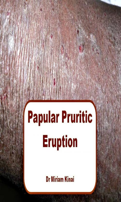 Cover of the book Papular Pruritic Eruption (PPE) by Miriam Kinai, Miriam Kinai