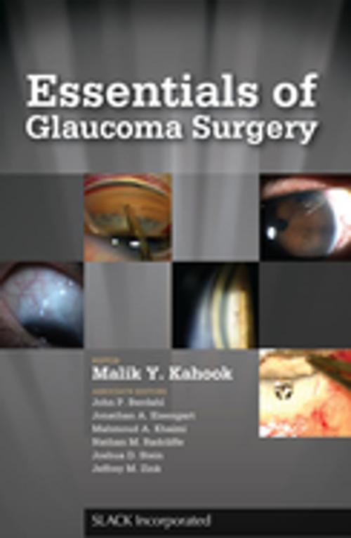 Cover of the book Essentials of Glaucoma Surgery by , SLACK Incorporated