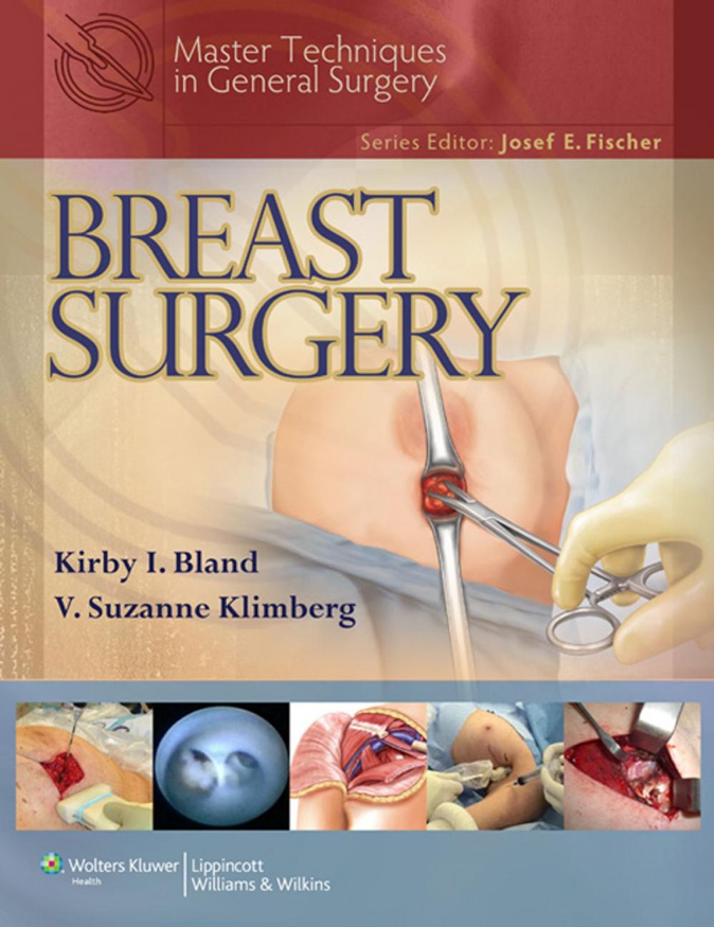 Big bigCover of Master Techniques in General Surgery: Breast Surgery