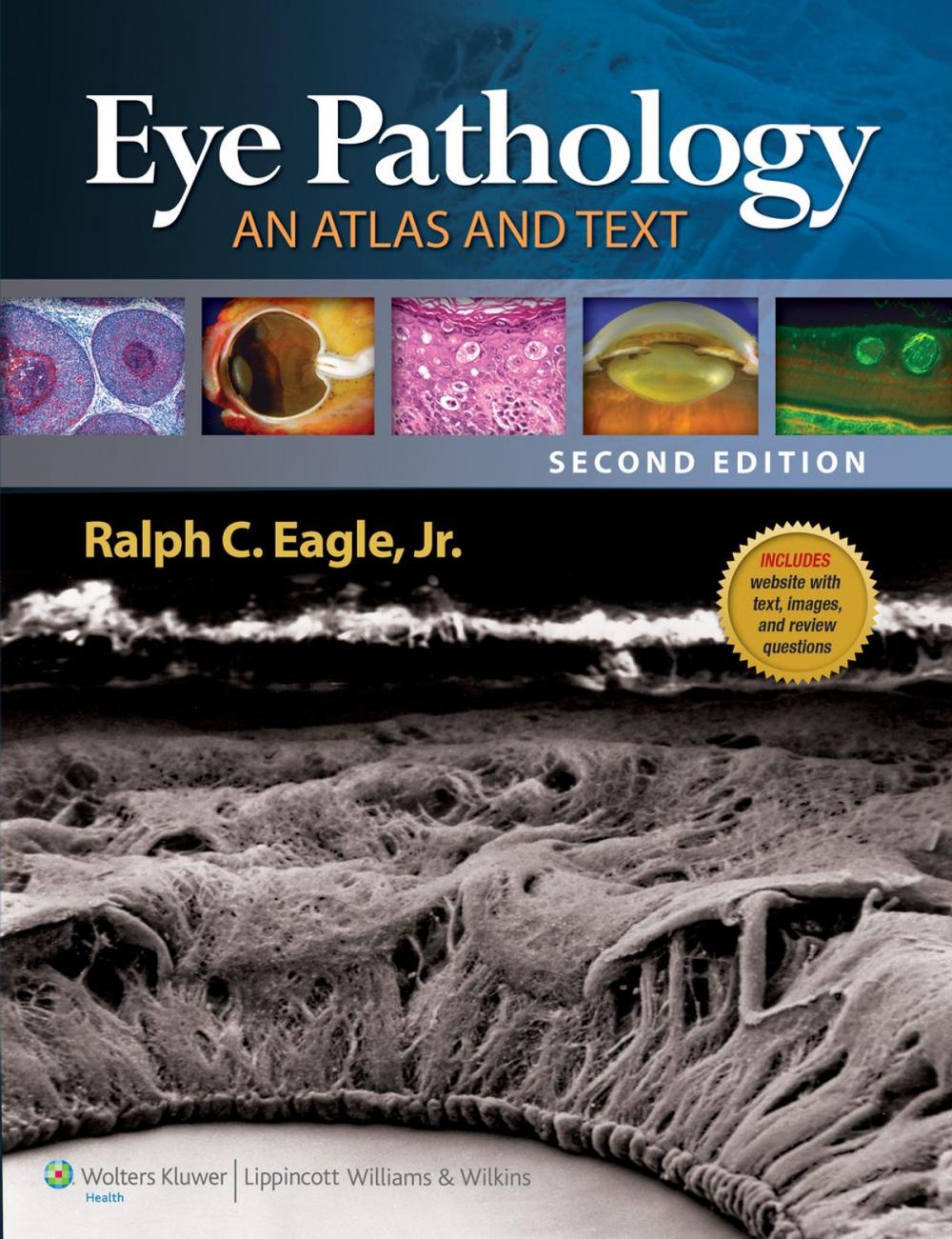 Big bigCover of Eye Pathology