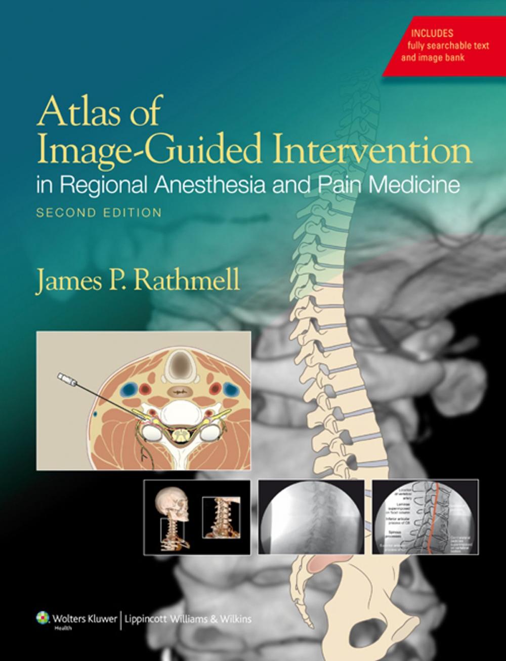 Big bigCover of Atlas of Image-Guided Intervention in Regional Anesthesia and Pain Medicine