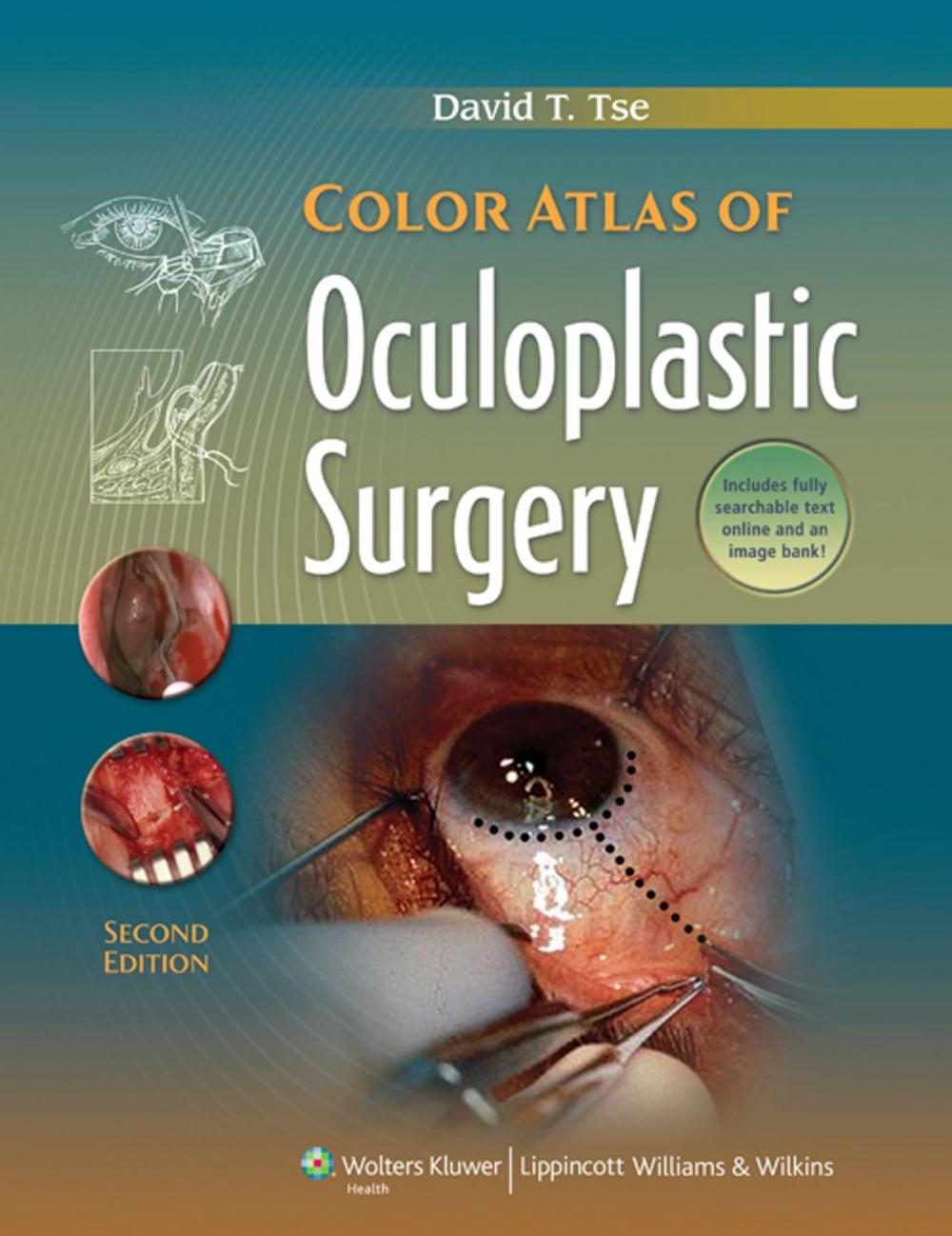 Big bigCover of Color Atlas of Oculoplastic Surgery