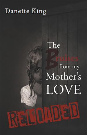 bigCover of the book The Bruises from my Mother's Love by 