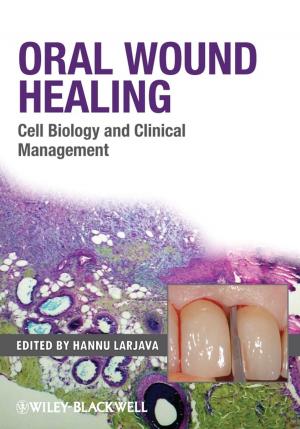 Cover of the book Oral Wound Healing by Eugene L. Madsen