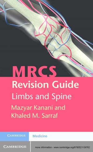 Cover of the book MRCS Revision Guide: Limbs and Spine by Nuno Borges Carvalho, Dominique Schreurs