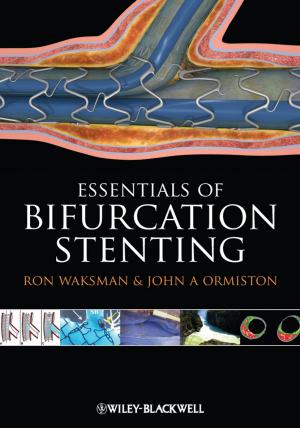 Cover of the book Bifurcation Stenting by Zeynep Ilsen Önsan, Ahmet Kerim Avci