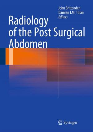 Cover of the book Radiology of the Post Surgical Abdomen by Casper Harteveld