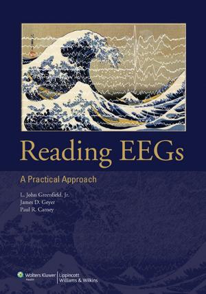 Cover of the book Reading EEGs: A Practical Approach by Sharon M. Weinstein, Mary E. Hagle