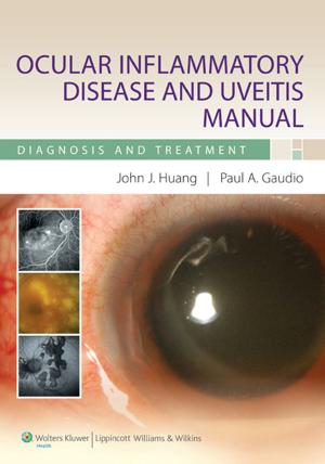 Cover of the book Ocular Inflammatory Disease and Uveitis Manual by Enrique Sánchez Goyanes