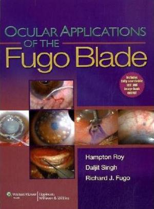 Cover of the book Ocular Applications of the Fugo Blade by Biren A. Shah, Sabala Mandava