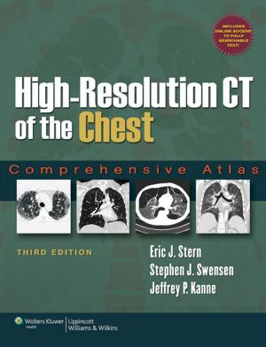 Cover of the book High-Resolution CT of the Chest by Stephen J. Gibson, Stefan Lautenbacher